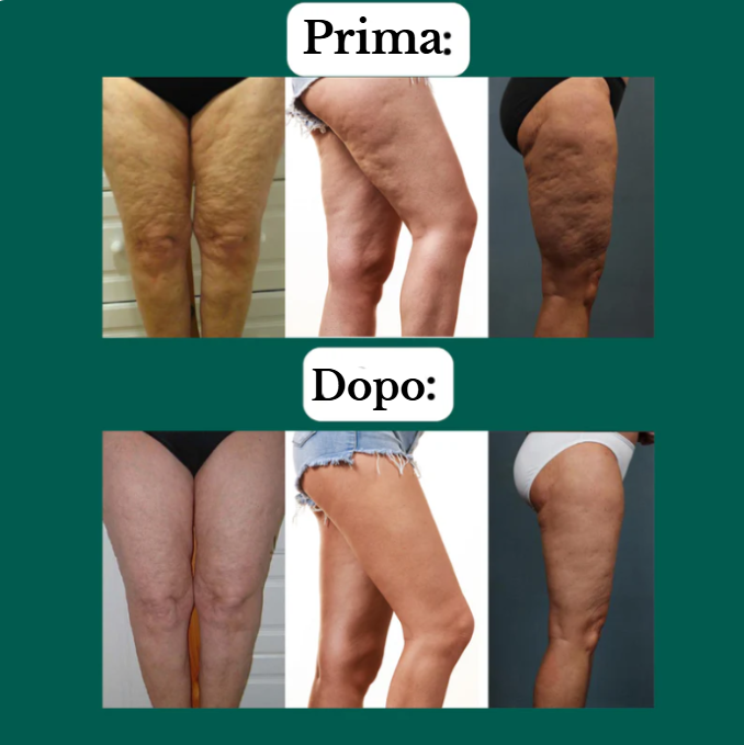 SkinLiftVac -  Skin Massager