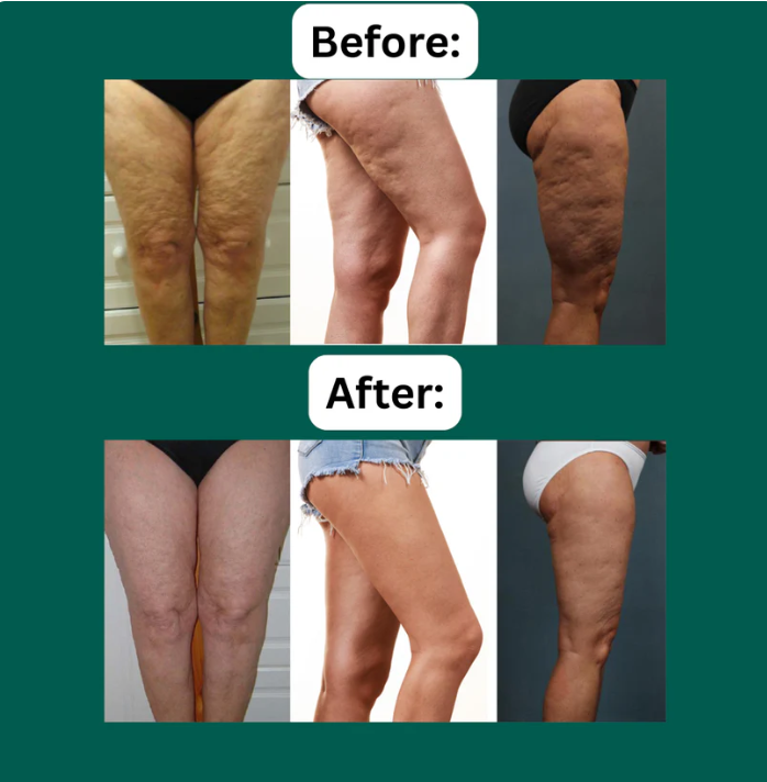 SkinLiftVac -  Skin Massager